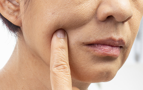 線維芽細胞の減少＝ しわやたるみの原因