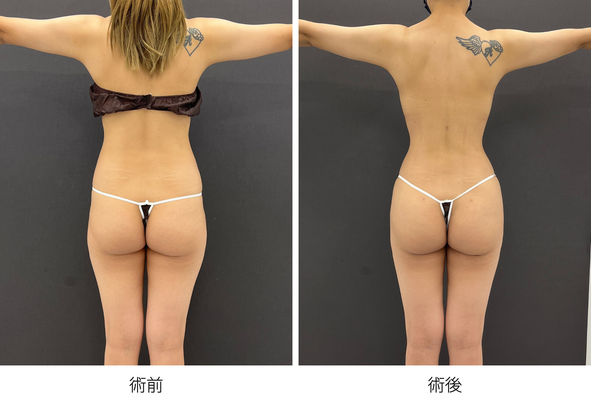 RibXcar ブラジリアンバットリフト くびれ 豊尻