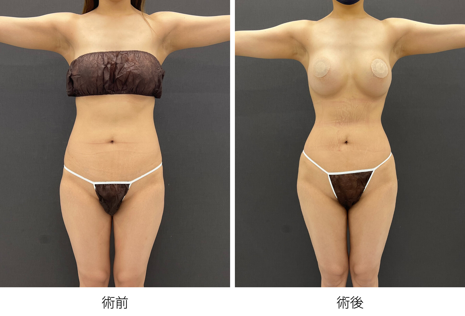 RibXcar ブラジリアンバットリフト くびれ 豊尻